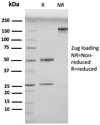 SDS-PAGE Analysis of Purified N-Cadherin Mouse Monoclonal Antibody (13A9). Confirmation of Integrity and Purity of Antibody.