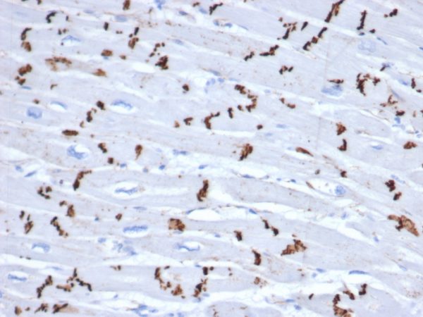 Formalin-fixed, paraffin-embedded human heart stained with N-Cadherin Recombinant Rabbit Monoclonal Antibody (CDH2/6857R).