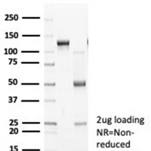 SDS-PAGE Analysis Purified N-Cadherin Recombinant Rabbit Monoclonal Antibody (CDH2/7070R). Confirmation of Purity and Integrity of Antibody.
