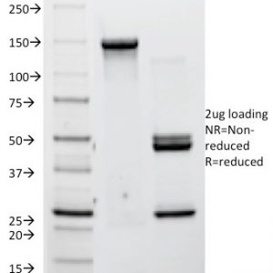 SDS-PAGE Analysis Purified P-Cadherin Mouse Monoclonal Antibody (12H6). Confirmation of Integrity and Purity of Antibody.