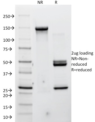 SDS-PAGE Analysis Purified P-Cadherin Mouse Monoclonal Antibody (12H6). Confirmation of Integrity and Purity of Antibody.