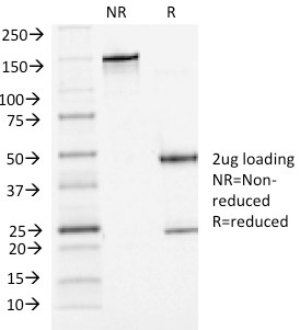 SDS-PAGE Analysis Purified P-Cadherin Mouse Monoclonal Antibody (6A9). Confirmation of Integrity and Purity of Antibody.
