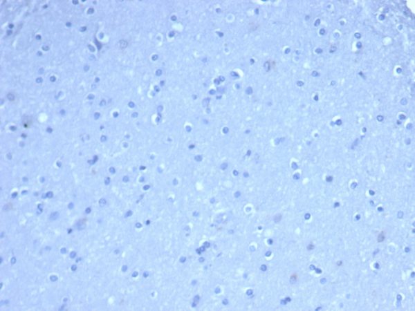 IHC analysis of formalin-fixed, paraffin-embedded human brain. Negative tissue control using TOM1L1/4690 at 2ug/ml in PBS for 30min RT. HIER: Tris/EDTA, pH9.0, 45min. 2°C: HRP-polymer, 30min. DAB, 5min.
