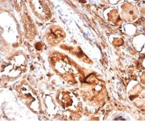 Formalin-fixed, paraffin-embedded human kidney stained with MICA Mouse Recombinant Monoclonal Antibody (MICA/4442). HIER: Tris/EDTA, pH9.0, 45min. 2 °: HRP-polymer, 30min. DAB, 5min.