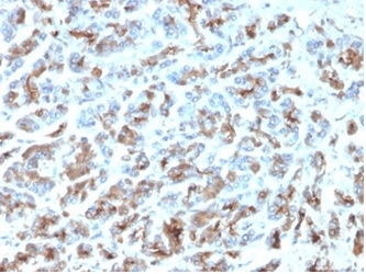 Formalin-fixed, paraffin-embedded human stomach stained with MICA Mouse Recombinant Monoclonal Antibody (MICA/4443). HIER: Tris/EDTA, pH9.0, 45min. 2 °: HRP-polymer, 30min. DAB, 5min.