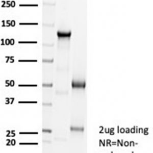 SDS-PAGE Analysis Purified CDH16 Rabbit Recombinant Monoclonal Antibody (CDH16/7027R). Confirmation of Purity and Integrity of Antibody.