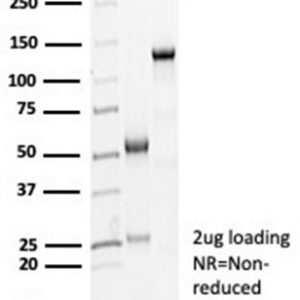 SDS-PAGE Analysis Purified CDH16 Rabbit Recombinant Monoclonal Antibody (CDH16/7028R). Confirmation of Purity and Integrity of Antibody.