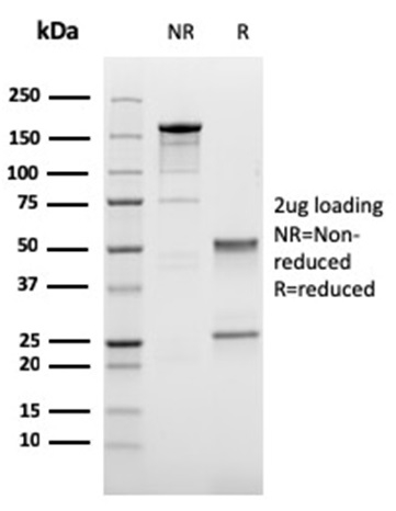 SDS-PAGE Analysis of Purified Cadherin 17 / CDH17 Mouse Monoclonal Antibody (CDH17/2616). Confirmation of Purity and Integrity of Antibody.