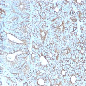 Formalin-fixed, paraffin-embedded human Colon stained with Cadherin 17 / CDH17 Mouse Monoclonal Antibody (CDH17/2617).
