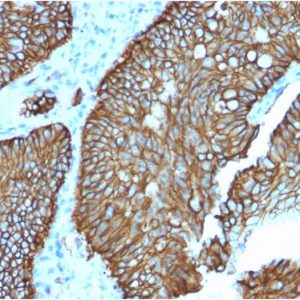 Formalin-fixed, paraffin-embedded human Colon stained with Cadherin 17 / CDH17 Mouse Monoclonal Antibody (CDH17/2618).