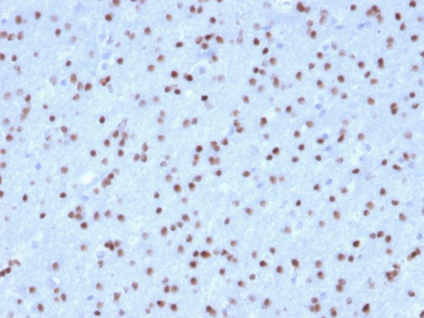 Formalin-fixed, paraffin-embedded human Cerebellum stained with OLIG2 Mouse Monoclonal Antibody (OLIG2/2400).