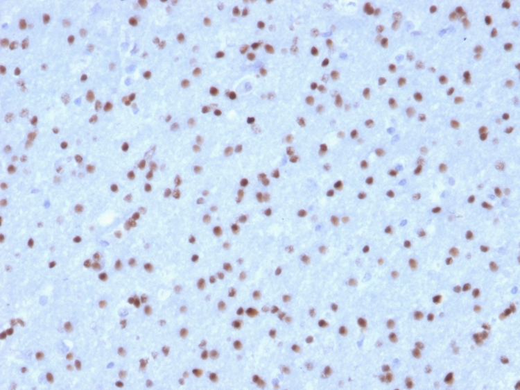 Formalin-fixed, paraffin-embedded human Cerebellum stained with OLIG2 Mouse Monoclonal Antibody (OLIG2/2400). OLIG2 (Marker of Glial Brain Tumors) Antibody