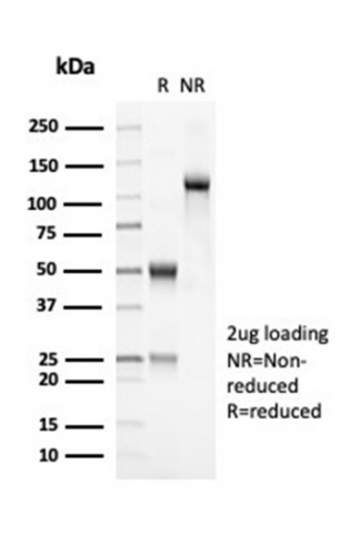 SDS-PAGE Analysis Purified OLIG2 Recombinant Rabbit Monoclonal Antibody (OLIG2/7074R). Confirmation of Purity and Integrity of Antibody.