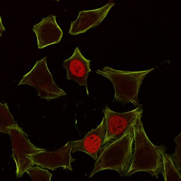 Immunofluorescence Analysis of HeLa cells labeling p21 with p21 Mouse Monoclonal Antibody (CIP1/823) followed by Goat anti-Mouse IgG-CF555 (Red). Membrane stained with Phalloidin 488 (Green)