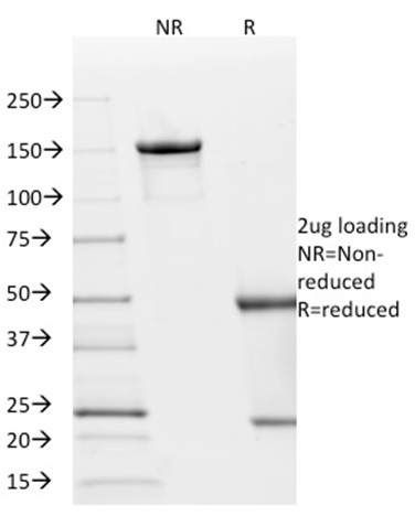 SDS-PAGE Analysis Purified p21 Mouse Monoclonal Antibody (AC8). Confirmation of Integrity and Purity of Antibody.
