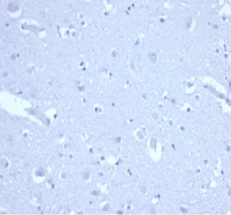 IHC analysis of formalin-fixed, paraffin-embedded human brain. Negative tissue control using CIP1/4377R at 2ug/ml in PBS for 30min RT. HIER: Tris/EDTA, pH9.0, 45min. 2 °: HRP-polymer, 30min. DAB, 5min.
