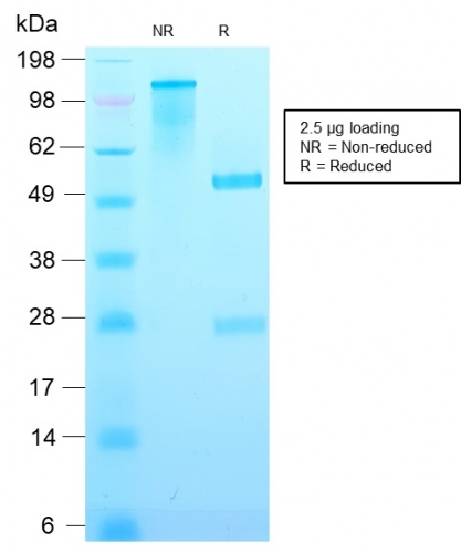 SDS-PAGE Analysis Purified p21 Rabbit Recombinant Monoclonal Antibody (CIP1/2489R). Confirmation of Purity and Integrity of Antibody.