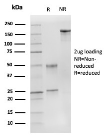 SDS-PAGE Analysis Purified p27 MAb (DCS-72.F6). Confirmation of Purity and Integrity of Antibody.
