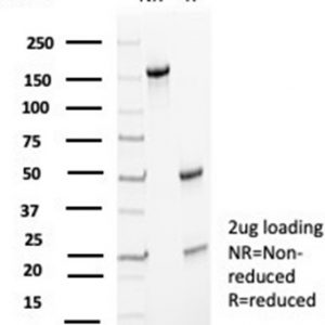 SDS-PAGE Analysis of Purified p27 Mouse Monoclonal Antibody (KIP1/1357). Confirmation of Purity and Integrity of Antibody.