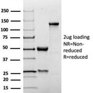 SDS-PAGE Analysis of Purified p27 Recombinant Rabbit Monoclonal Antibody (KIP1/1355R). Confirmation of Purity and Integrity of Antibody.