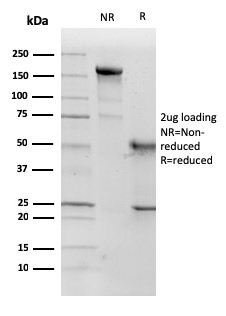 SDS-PAGE Analysis Purified p57 Monoclonal Antibody (KP10). Confirmation of Purity and Integrity of Antibody