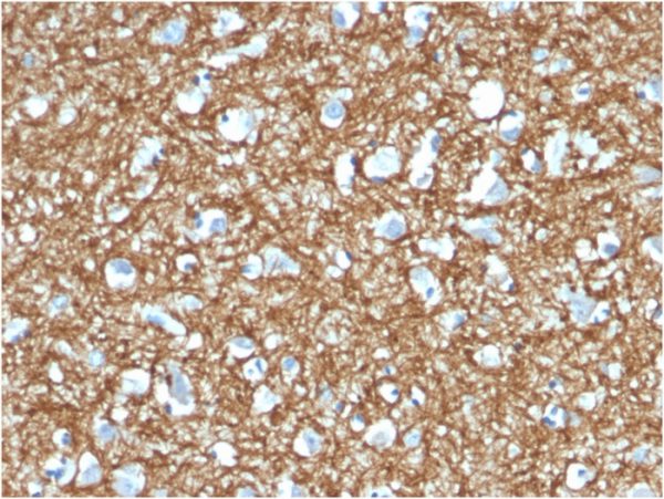 Formalin-fixed, paraffin-embedded human Brain stained with p14ARF Mouse Monoclonal Antibody (4C6/4).