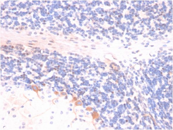 Formalin-fixed, paraffin-embedded rat Brain stained with p14ARF Mouse Monoclonal Antibody (4C6/4).