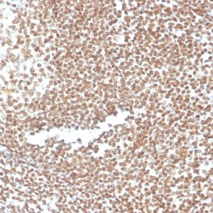 Formalin-fixed, paraffin-embedded human colon stained with P16INK4a Mouse Monoclonal Antibody (CDKN2A/3830).