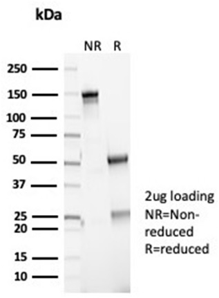 SDS-PAGE Analysis Purified P16INK4a Recombinant Rabbit Monoclonal (CDKN2A/7081R). Confirmation of Purity and Integrity of Antibody.