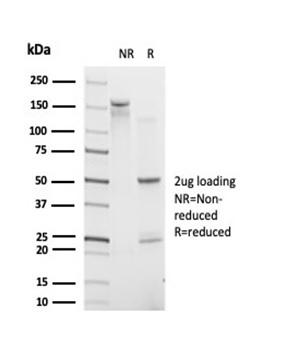 SDS-PAGE Analysis. Purified IRF9 Mouse Monoclonal Antibody (PCRP-IRF9-2F8). Confirmation of Purity and Integrity of Antibody.