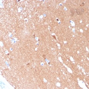 Formalin-fixed, paraffin-embedded human Brain stained with Tubulin beta 3 Mouse Monoclonal Antibody (TUBB3/3731).