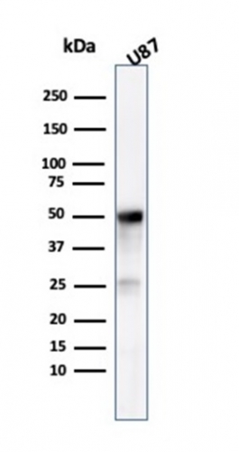Western Blot Analysis of U87 cell lysate using Tubulin beta 3 Mouse Monoclonal Antibody (TUBB3/3731).