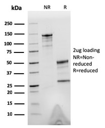 SDS-PAGE Analysis. Purified Tubulin beta 3 Mouse Monoclonal Antibody (TUBB3/3732). Confirmation of Purity and Integrity of Antibody.
