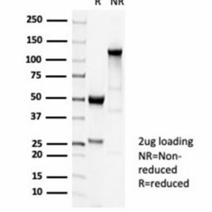 SDS-PAGE Analysis Purified TUBB3 Recombinant Rabbit Monoclonal Antibody (TUBB3/7089R). Confirmation of Purity and Integrity of Antibody.