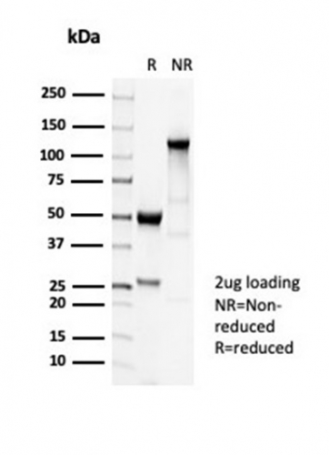 SDS-PAGE Analysis Purified TUBB3 Recombinant Rabbit Monoclonal Antibody (TUBB3/7089R). Confirmation of Purity and Integrity of Antibody.