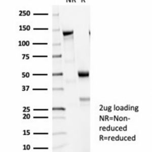 SDS-PAGE Analysis Purified TUBB3 Recombinant Rabbit Monoclonal Antibody (TUBB3/7090R). Confirmation of Purity and Integrity of Antibody.