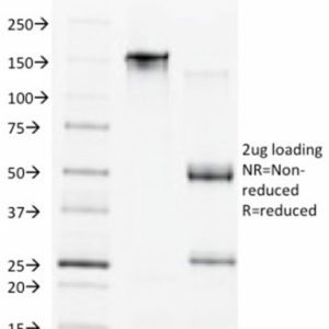 SDS-PAGE Analysis of Purified CDX1 Mouse Monoclonal Antibody (CDX1/1650). Confirmation of Purity and Integrity of Antibody.