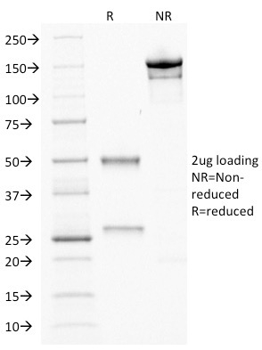 SDS-PAGE Analysis Purified CDX2 Mouse Monoclonal Antibody (CDX2/1690). Confirmation of Purity and Integrity of Antibody.