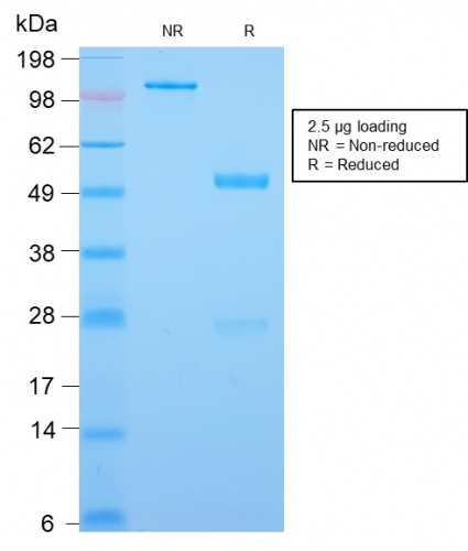 SDS-PAGE Analysis Purified CDX2 Rabbit Recombinant Monoclonal Antibody (CDX2/2951R). Confirmation of Purity and Integrity of Antibody.