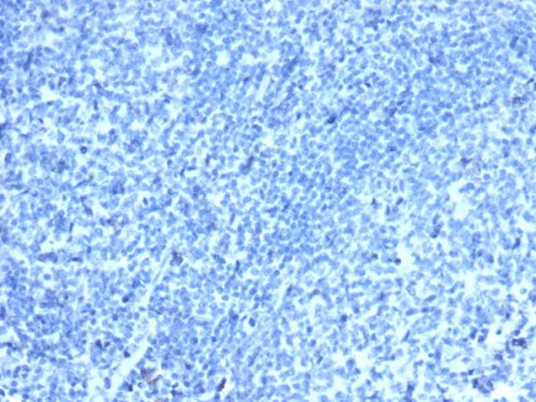 IHC analysis of formalin-fixed, paraffin-embedded human tonsil. Negative tissue control using CDX2/4394R at 2ug/ml in PBS for 30min RT. HIER: Tris/EDTA, pH9.0, 45min. 2°: HRP-polymer, 30min. DAB, 5min.