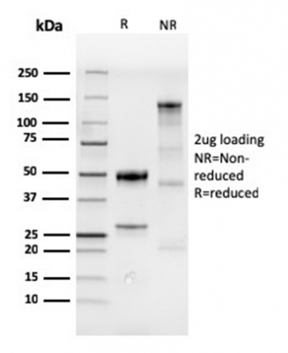 SDS-PAGE Analysis of Purified CDX2 Recombinant Rabbit Monoclonal Antibody (CDX2/4394R). Confirmation of Purity and Integrity of Antibody.