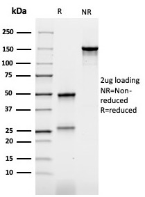 SDS-PAGE Analysis Purified CEA Mouse Recombinant Monoclonal Antibody (rC66/1009). Confirmation of Purity and Integrity of Antibody.