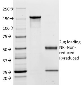 SDS-PAGE Analysis of Purified CEA Mouse Monoclonal Antibody (C66/195). Confirmation of Purity and Integrity of Antibody.