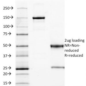 CEA Antibody in SDS-PAGE
