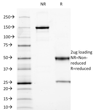 SDS-PAGE Analysis Purified CEA Mouse Monoclonal Antibody (C66/1009). Confirmation of Purity and Integrity of Antibody.