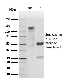 SDS-PAGE Analysis Purified CEA Rabbit Recombinant Monoclonal Antibody (C66/2055R). Confirmation of Purity and Integrity of Antibody.