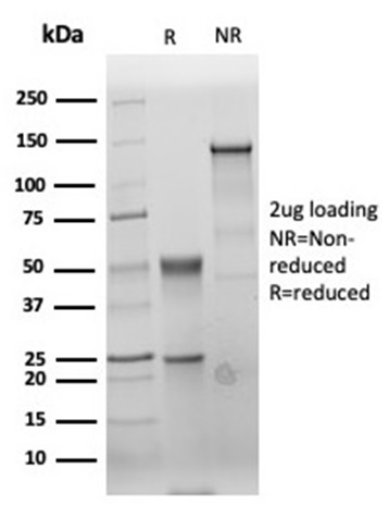 SDS-PAGE Analysis of Purified CEA Rabbit Recombinant Monoclonal Antibody (C66/6470R). Confirmation of Purity and Integrity of Antibody.