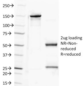 SDS-PAGE Analysis of Purified CD100 Mouse Monoclonal Antibody (A8). Confirmation of Purity and Integrity of Antibody.
