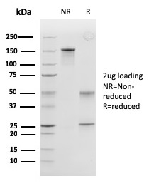 SDS-PAGE Analysis Purified Peroxiredoxin 4 Monoclonal Antibody (CPTC-PRDX4-2). Confirmation of Purity and Integrity of Antibody.