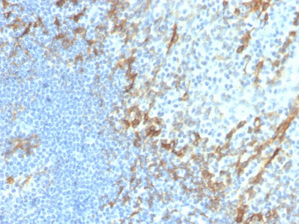 Formalin-fixed, paraffin-embedded human tonsil stained with Podoplanin Recombinant Rabbit Monoclonal Antibody (PDPN/4009R).